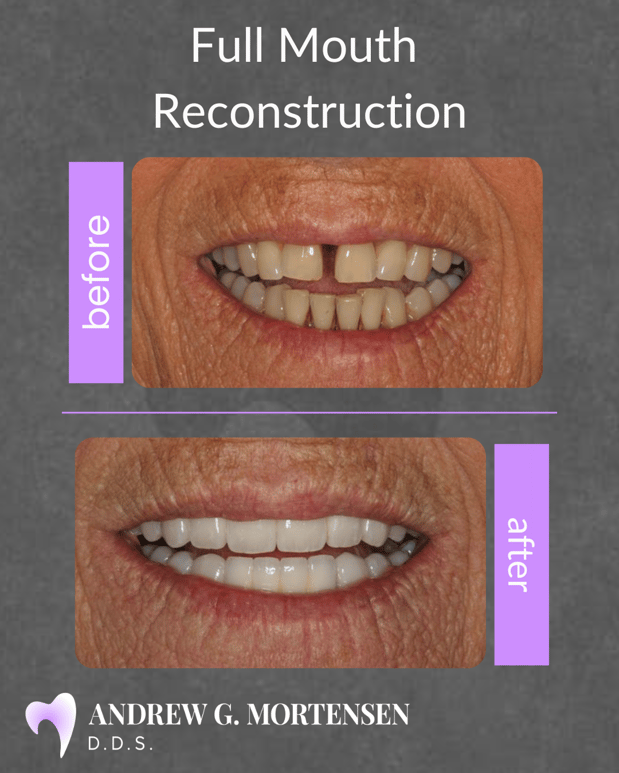 Images Andrew G. Mortensen, DDS