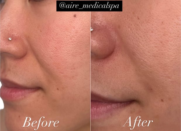 Images Aire Medical Spa