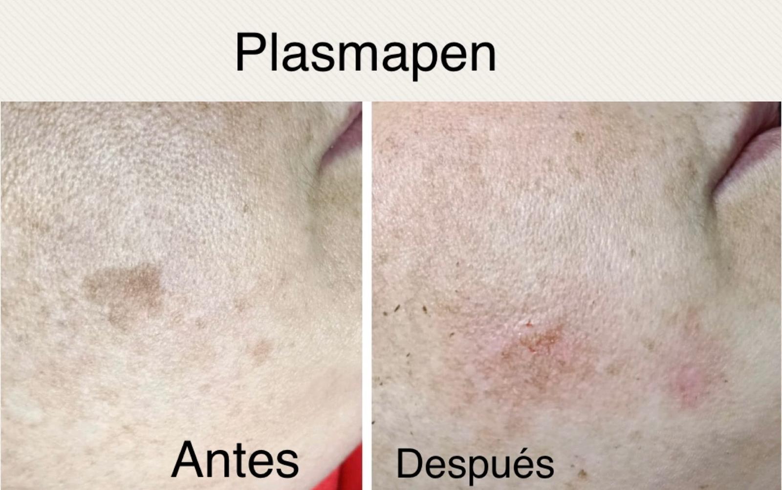 Images Centro De Estética Avanzada Y Láser Verónica Vico