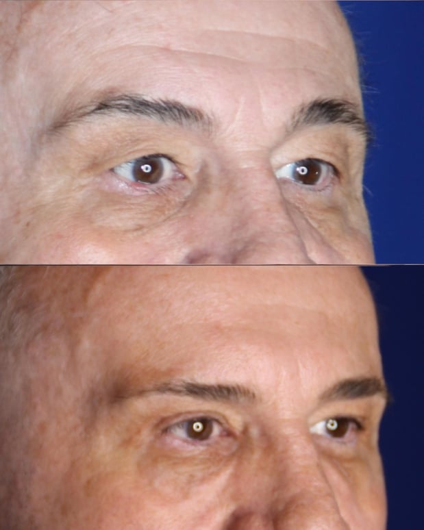 Images Troell Cosmetic Surgery & Facial Plastic Clinic