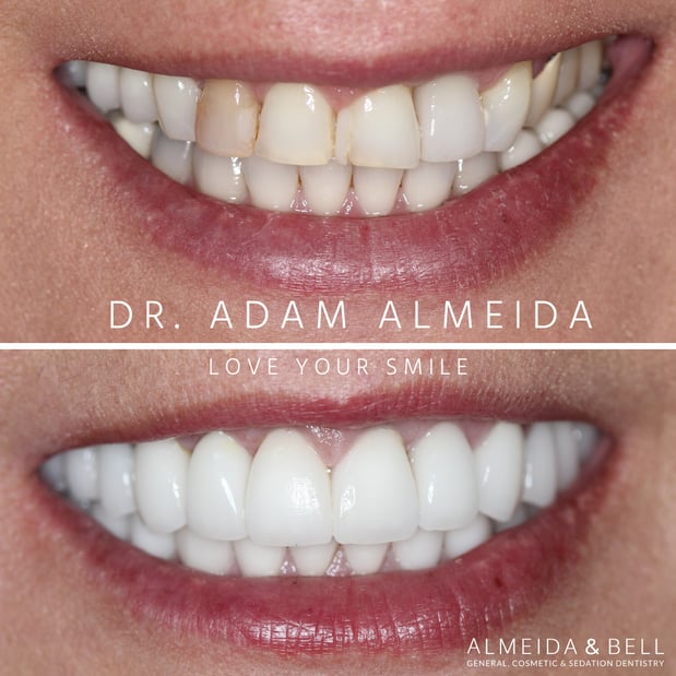 Images Almeida & Bell Dental Lone Tree - General, Cosmetic, and Implant Dentistry