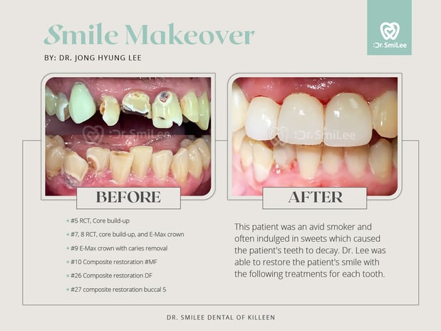 Images Dr Smilee Dental of Killeen, Family, Cosmetic, Implant, Medspa
