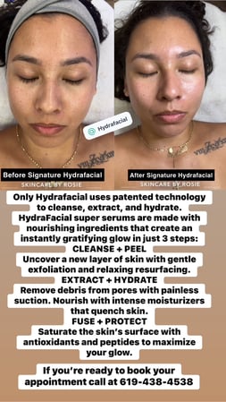 Images Skincare by Rosie