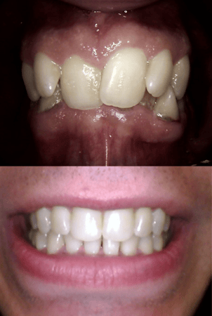 Images SoftTouch Dentistry of Newton