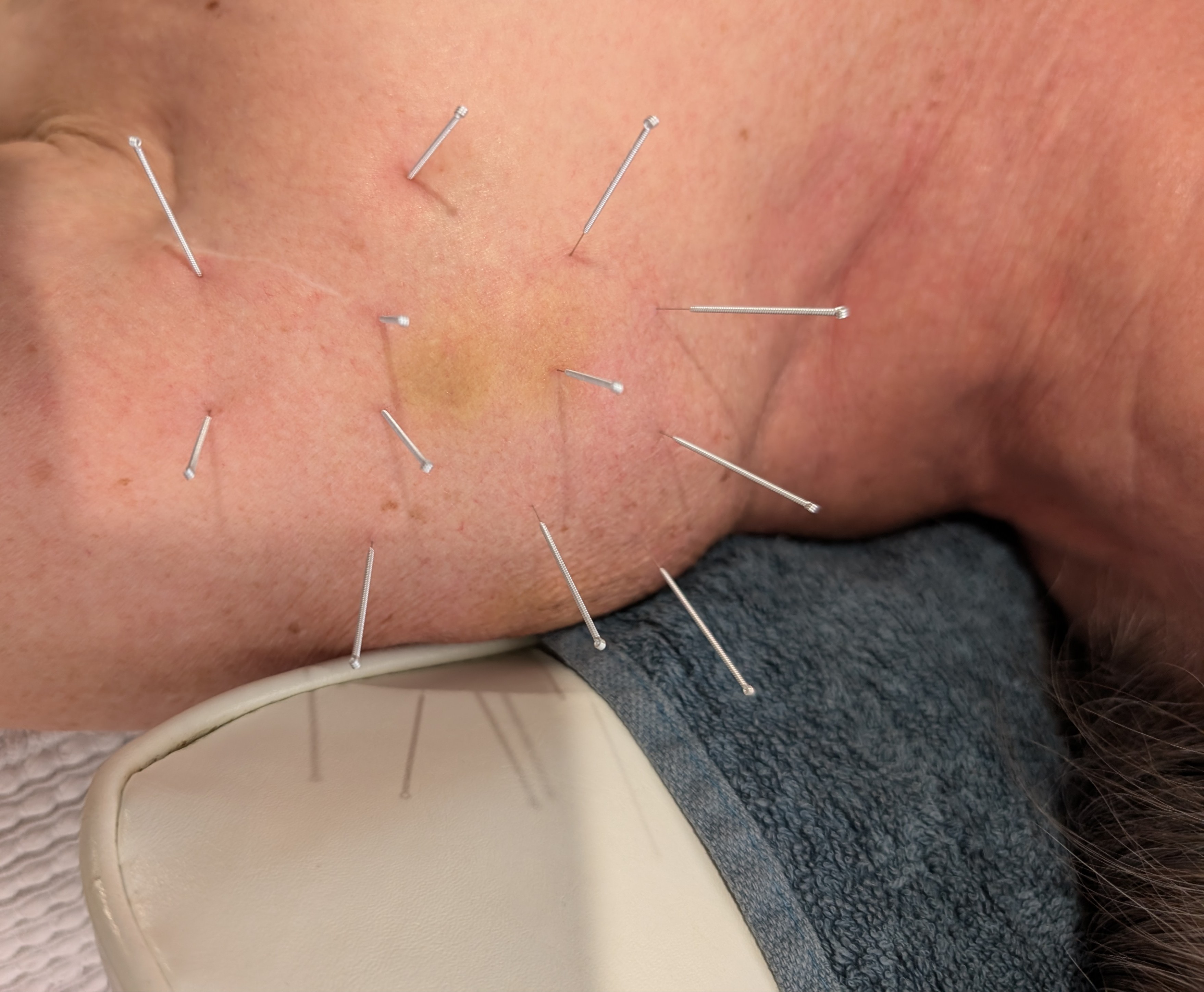 Images HealthFirst Therapies and Massage