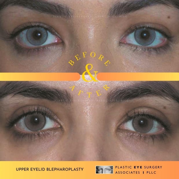 Images Plastic Eye Surgery Associates, PLLC