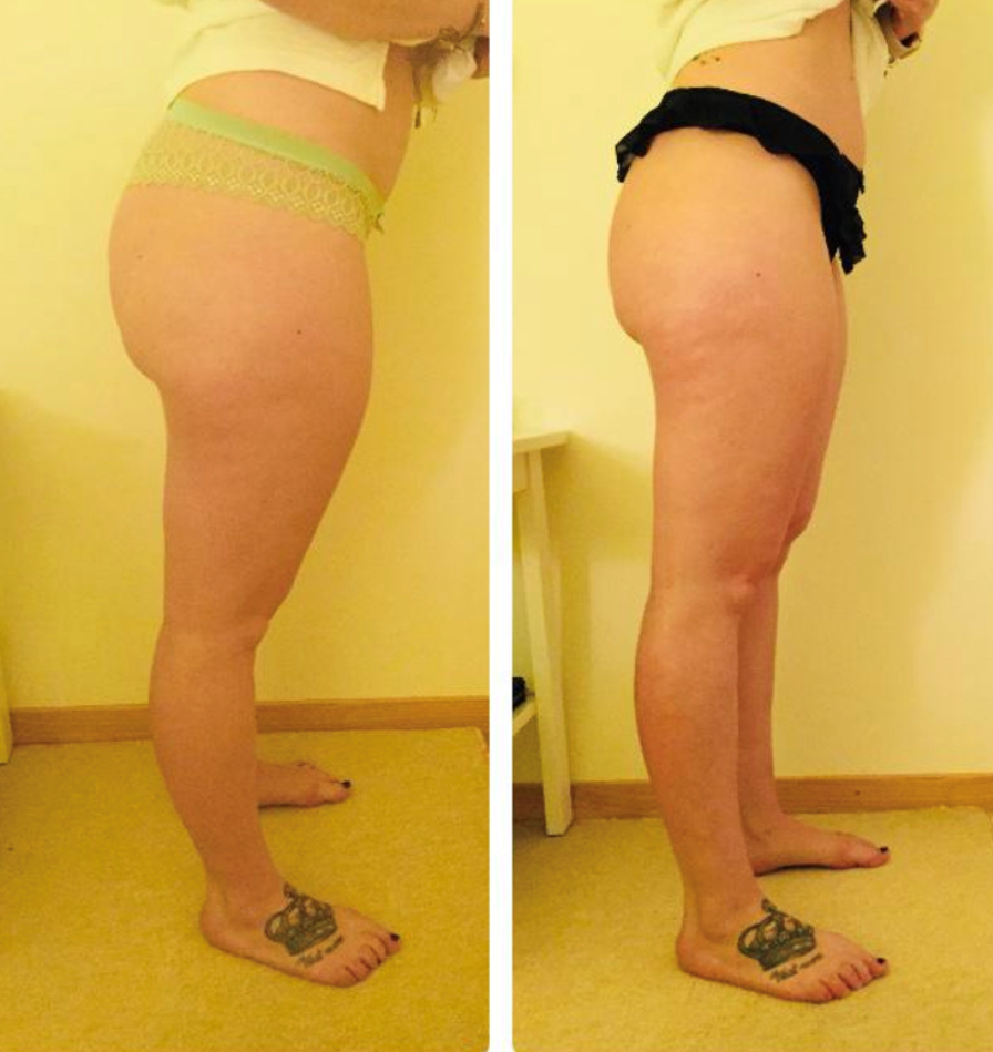 Vacuum Fit 100, Ackerstrasse 16 in Kloten