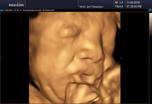 Images Heavenly 3D 4D Ultrasounds