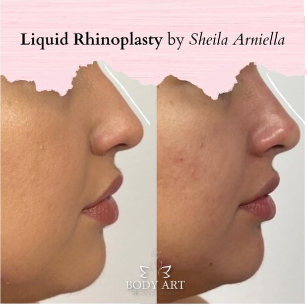 Images Body Art Rejuvenation