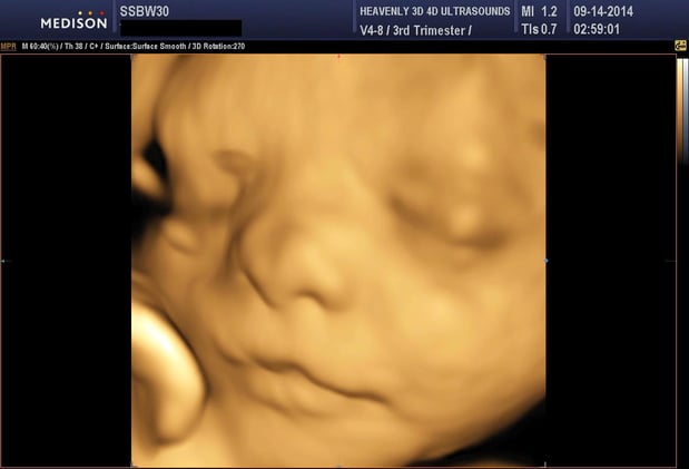 Images Heavenly 3D 4D Ultrasounds-Upland