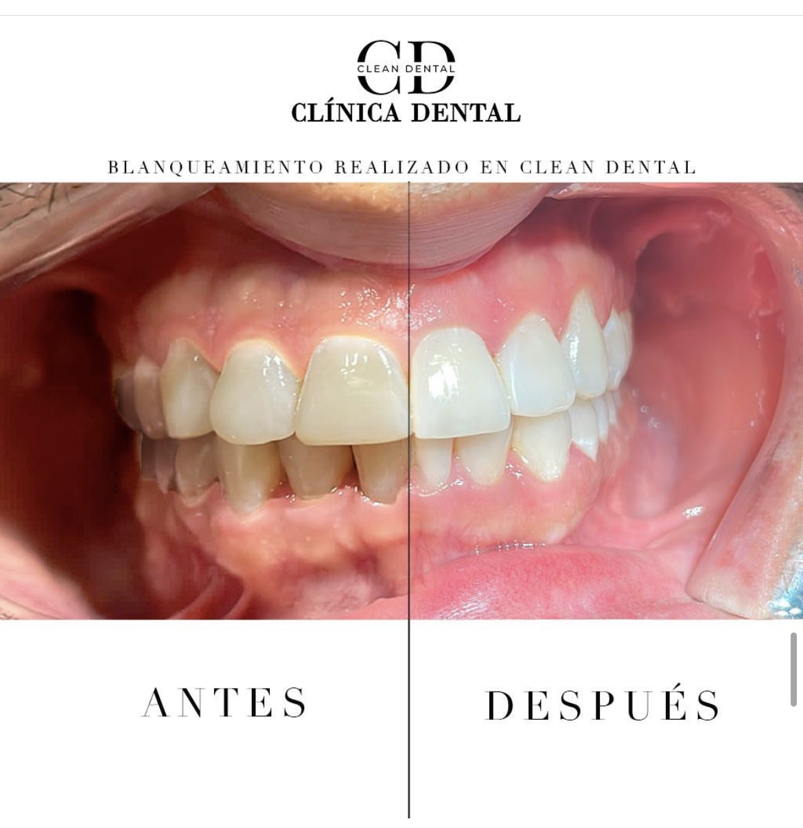 Images Clean Dental