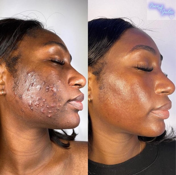 Images Face of Jules