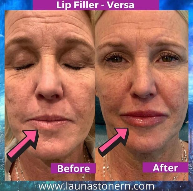 Images Launa Stone, R.N.