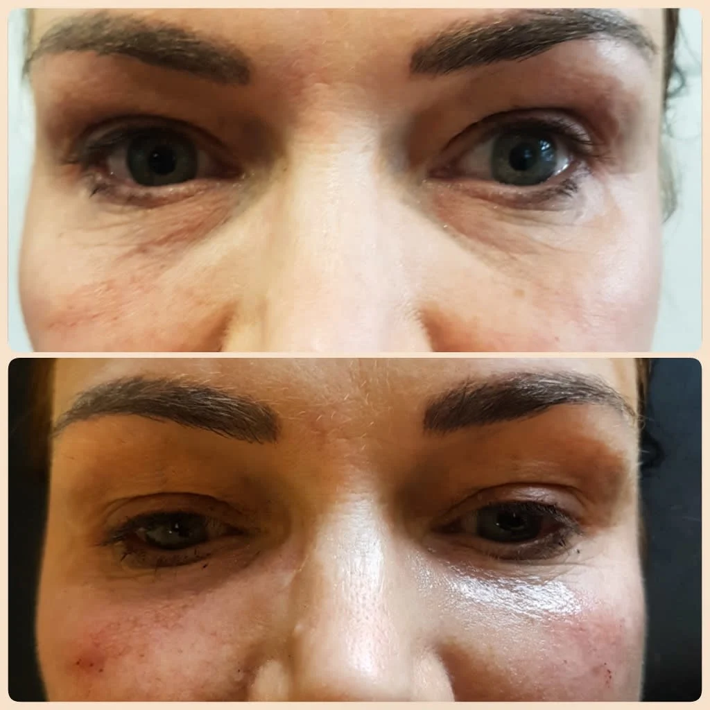 Images Lincoln Aesthetic