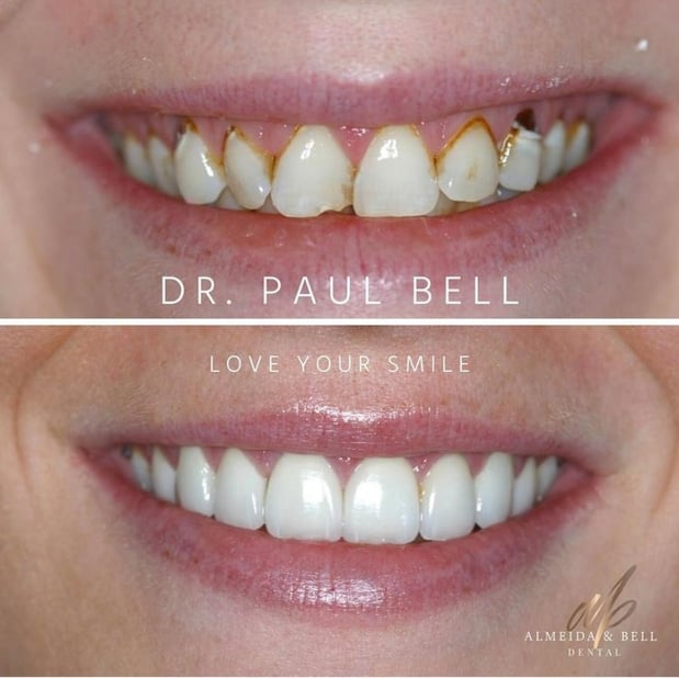 Images Almeida & Bell Dental Lone Tree - General, Cosmetic, and Implant Dentistry