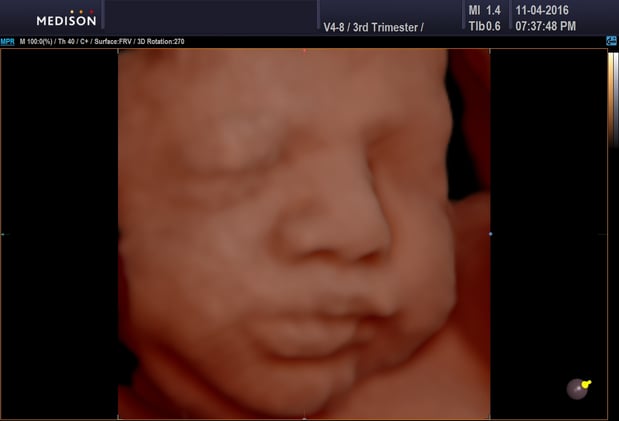Images Heavenly 3D 4D Ultrasounds