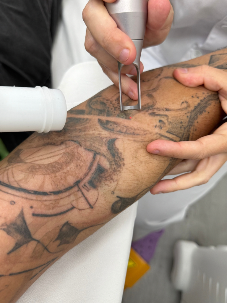 Images Dra. Silvia Solà. Medicina Estética y Láser