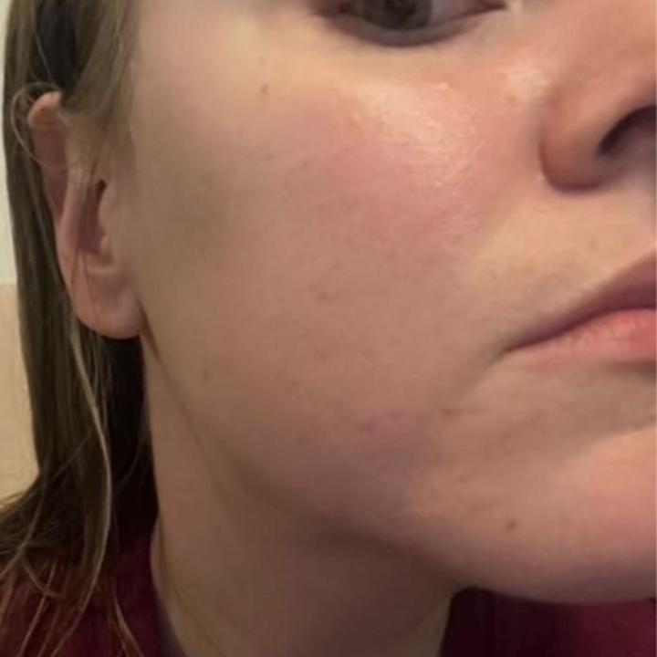 Images DERMA GLOW SOUTH YARRA ( Formerly Known as ALS)