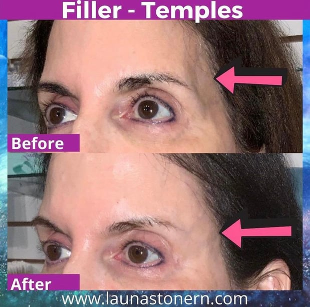 Images Launa Stone, R.N.