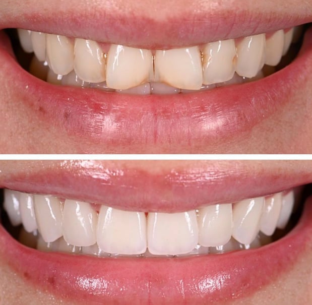 Images Northeast Lincoln Family Dentistry