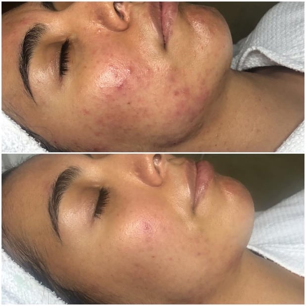 Images Permanent Makeup & Aesthetics in Maine