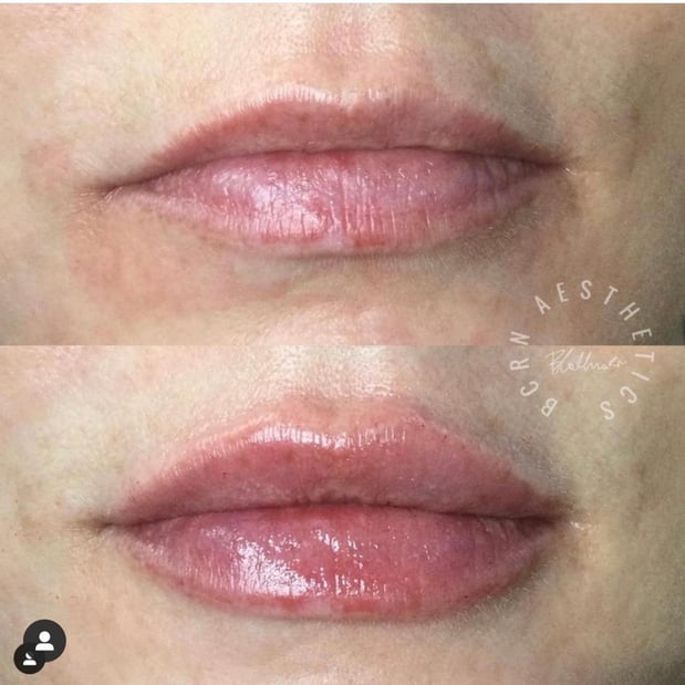 Images BCRN Aesthetics MedSpa