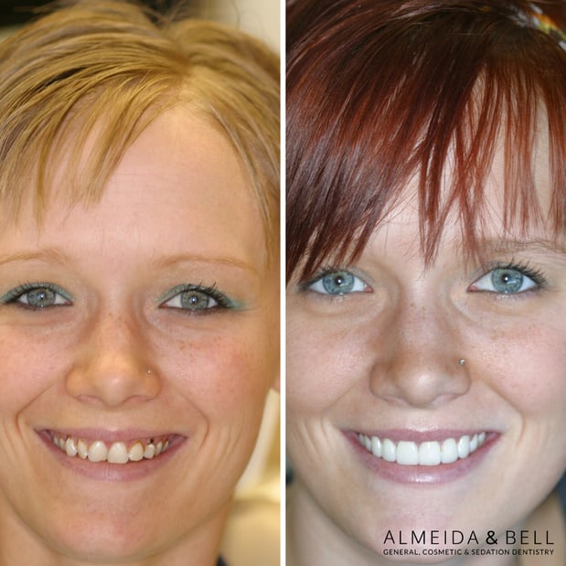 Images Almeida & Bell Dental Lone Tree - General, Cosmetic, and Implant Dentistry