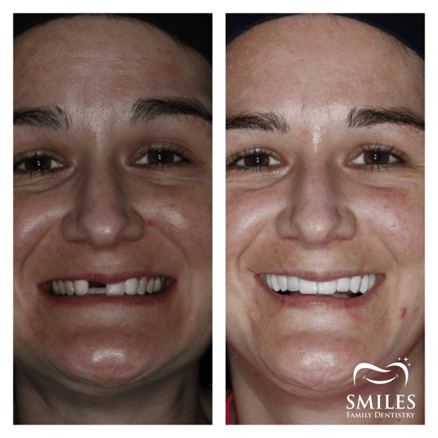 Images Brunswick Smiles Family Dentistry Implant, Oral Surgery, and Cosmetic Dentist