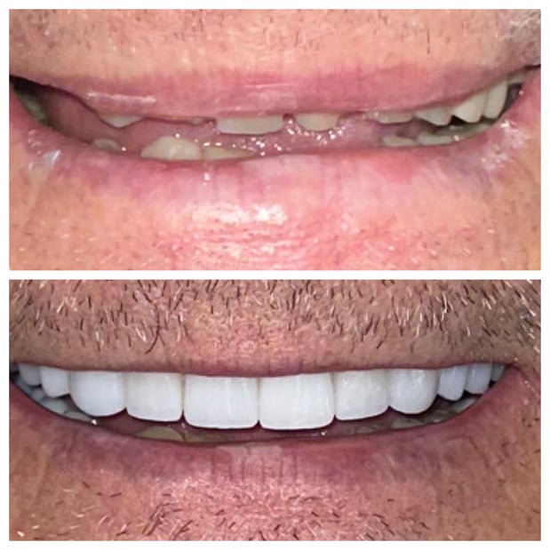 Images Summerlin Dental Solutions