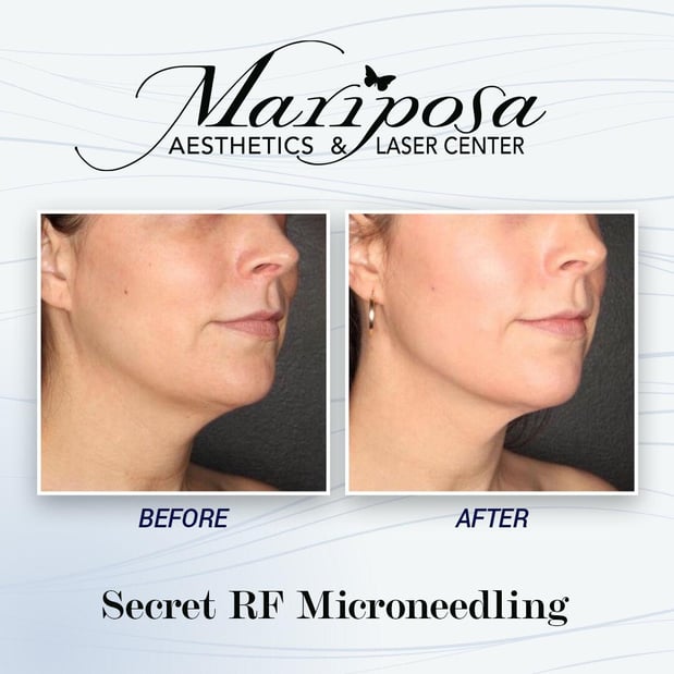 Images Mariposa Aesthetics & Laser Center