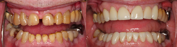 Images Cosmetic and Implant Dentistry of Connecticut