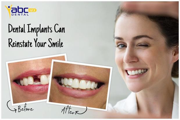 Images ABC 123 Dental Of Keller