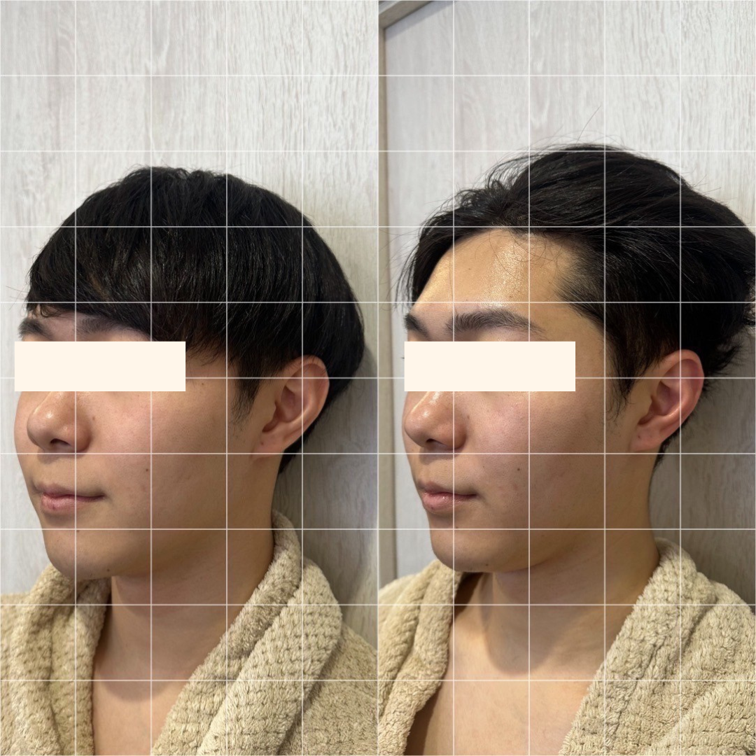 Images アディス リティフル