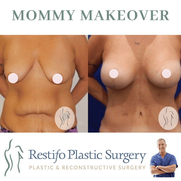 Images Restifo Plastic Surgery