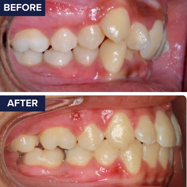 Images Orthodontics of Santa Barbara