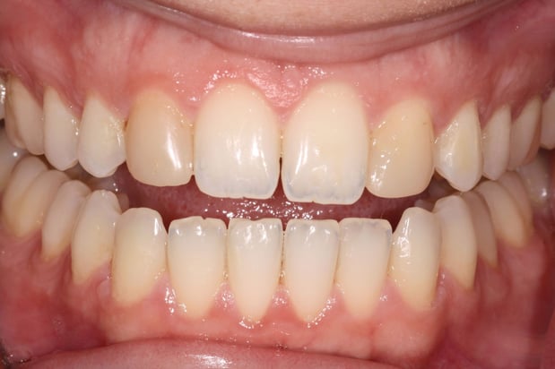 Images North Salem Dental Care