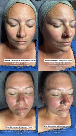 Images Skincare by Rosie