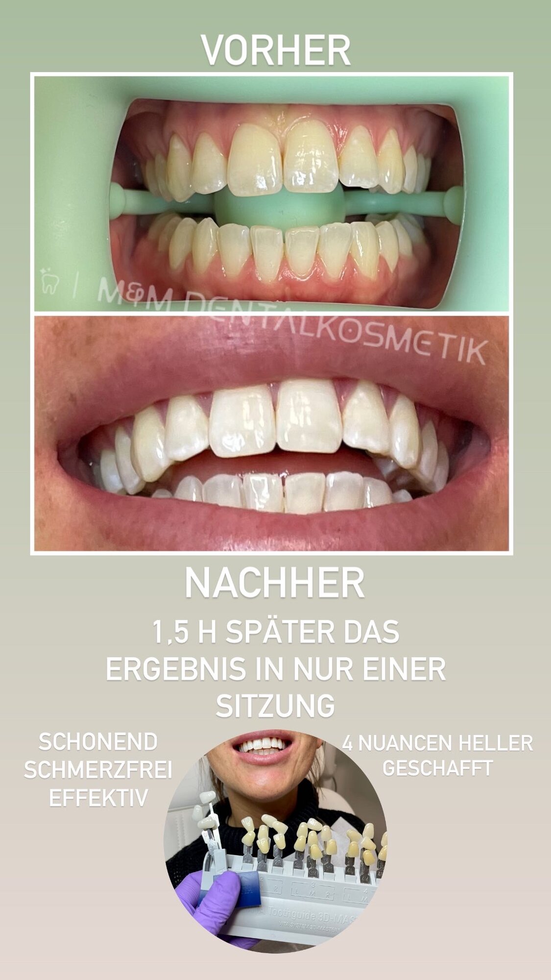 Bild 5 M&M Dentalkosmetik in Reutlingen