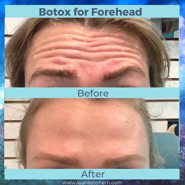 Images Launa Stone, R.N.