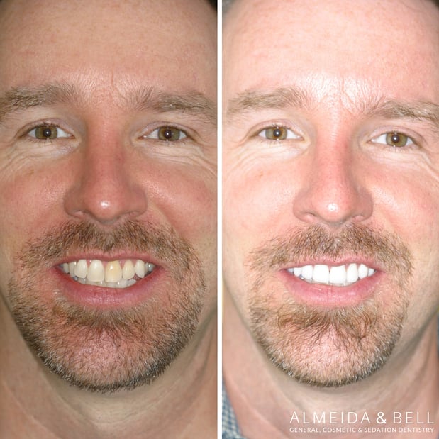 Images Almeida & Bell Dental Lone Tree - General, Cosmetic, and Implant Dentistry
