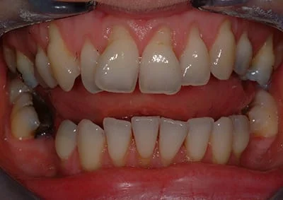 Images Smile Dental Laboratory