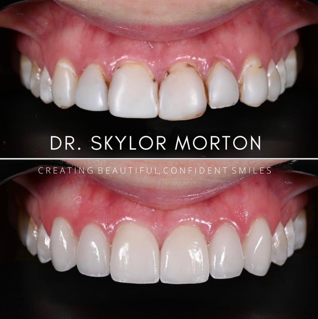 Images Nashville Wisdom Teeth and Implant Solutions
