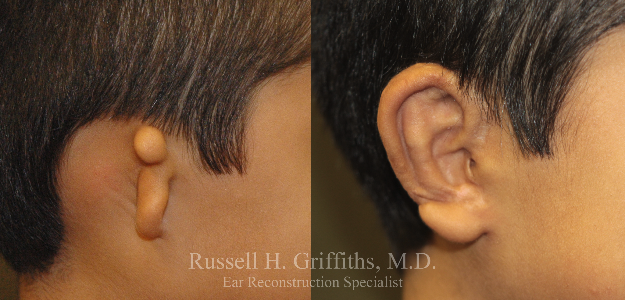 Results of Russell H. Griffiths, MD | Boise, ID