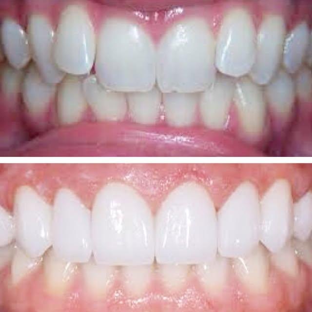Images Smiles By Eddie: Dr. Edmond Ahdoot DDS