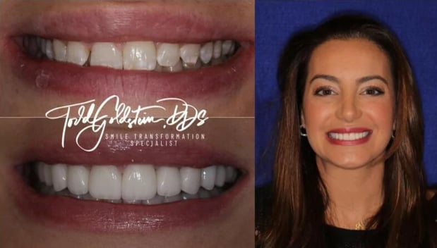 Images Todd Goldstein DDS