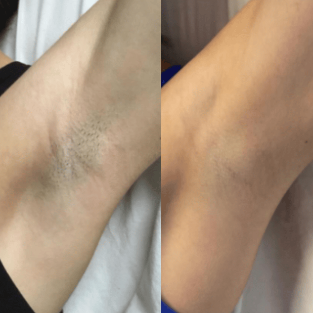 Images Cedar Grove Aesthetics