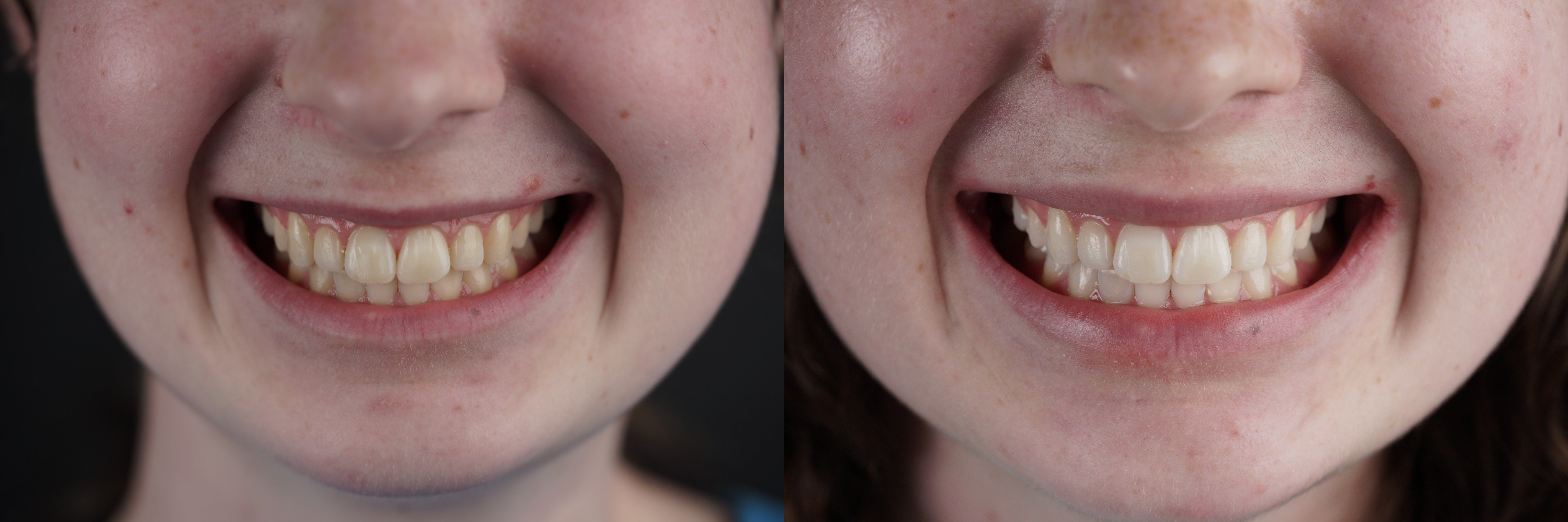 Watters Creek Dental Image