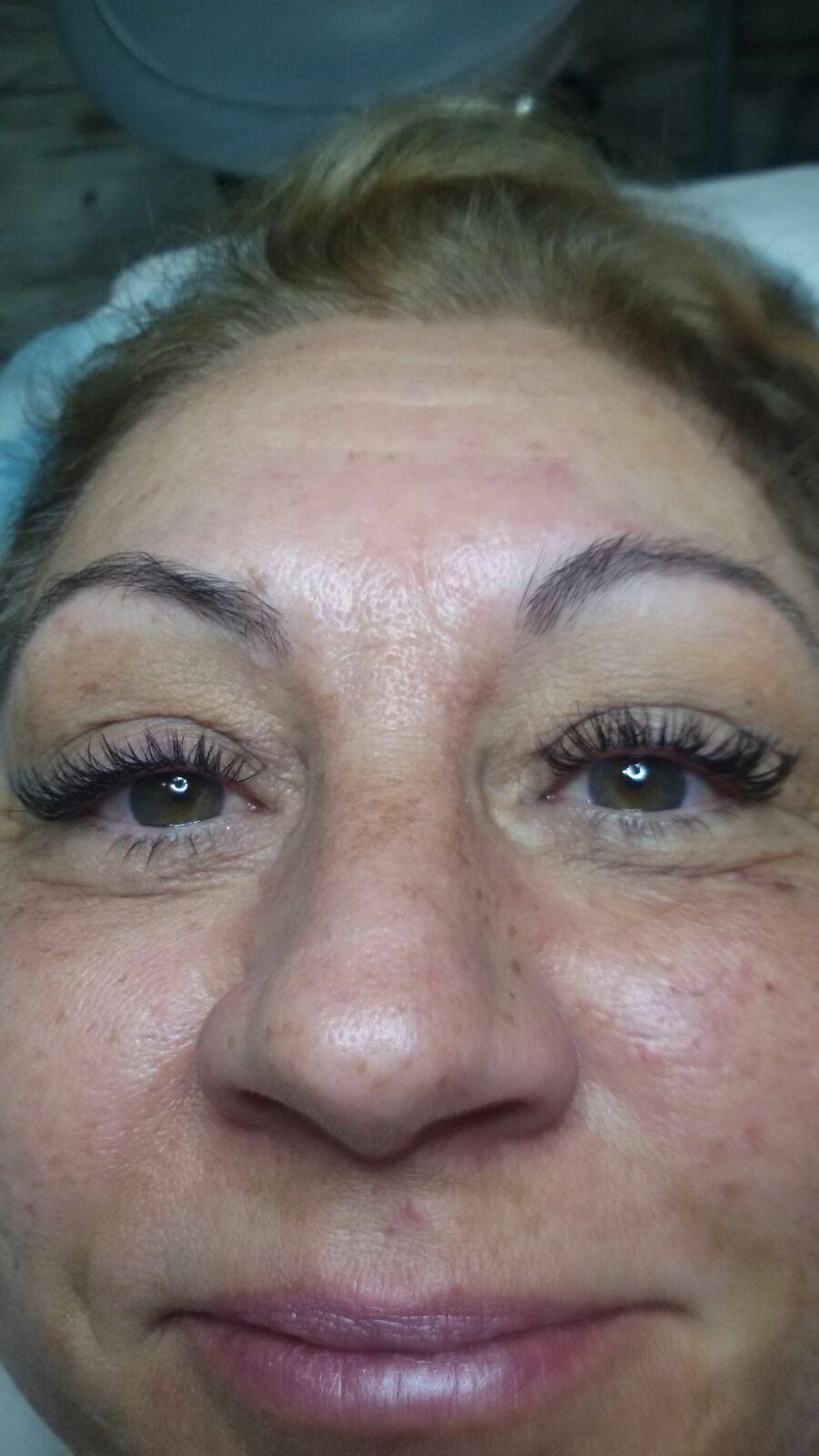 Images Fv Láser Nails Beauty