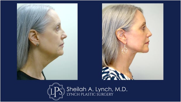Images Dr. Sheilah A. Lynch