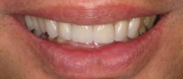 Images Glenlake Dental Care
